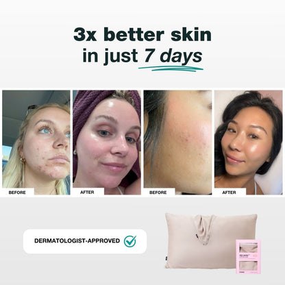 The Anti-Acne Silk Pillowcase